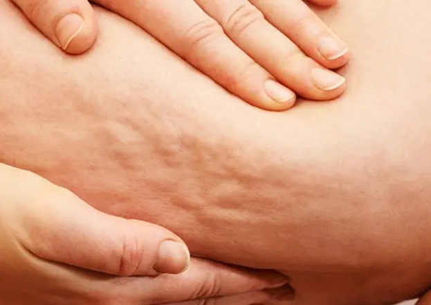 Tratamento corporal em área abdominal
